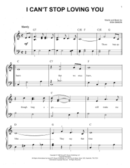 page one of I Can't Stop Loving You (Easy Piano)